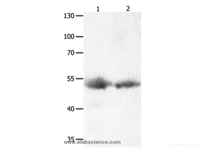 Western Blot analysis of Human lymphoma and liver cancer tissue using JNK1 Polyclonal Antibody at dilution of 1:1000