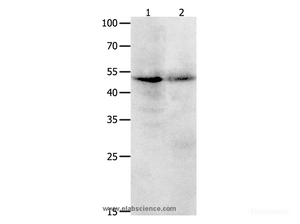 Western Blot analysis of Jurkat cell and Human ovarian cancer tissue using KLF5 Polyclonal Antibody at dilution of 1:1700