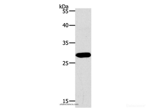 Western Blot analysis of Jurkat cell using PAX5 Polyclonal Antibody at dilution of 1:550