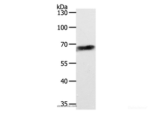 Western Blot analysis of Jurkat cell using ABCD4 Polyclonal Antibody at dilution of 1:700