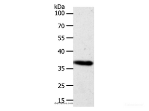 Western Blot analysis of Hela cell using AKR1B1 Polyclonal Antibody at dilution of 1:700