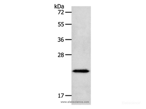 Western Blot analysis of Human liver cancer tissue using NEUROG1 Polyclonal Antibody at dilution of 1:400