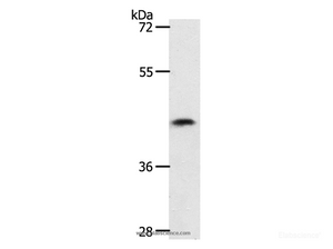 Western Blot analysis of 231 cell using PLAT Polyclonal Antibody at dilution of 1:450