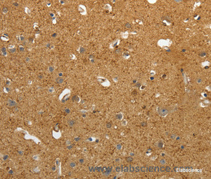 Immunohistochemistry of paraffin-embedded Human brain tissue using AKAP12 Polyclonal Antibody at dilution 1:40