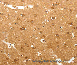 Immunohistochemistry of paraffin-embedded Human brain tissue using MAP1B Polyclonal Antibody at dilution 1:60