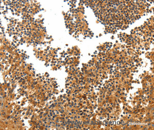 Immunohistochemistry of paraffin-embedded Human tonsil tissue using TERT Polyclonal Antibody at dilution 1:40