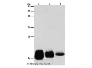 Western Blot analysis of Huvec, hela and SKOV3 cell using CD59 Polyclonal Antibody at dilution of 1:500
