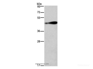 Western Blot analysis of 231 cell using RAGE Polyclonal Antibody at dilution of 1:750