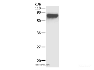 Western Blot analysis of HepG2 cell using AFP Polyclonal Antibody at dilution of 1:1000