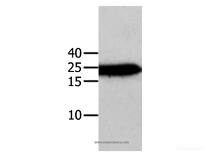 Western Blot analysis of Human cervical cancer tissue using ANXA5 Polyclonal Antibody at dilution of 1:750