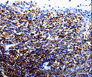 Immunohistochemistry of paraffin-embedded Human tosil tissue using IL10RA Polyclonal Antibody at dilution 1:60