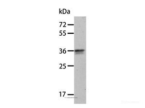 Western Blot analysis of A549 cell using ANXA8 Polyclonal Antibody at dilution of 1:300