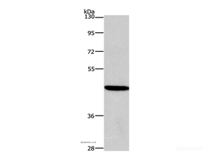 Western Blot analysis of 293T cell using HDAC8 Polyclonal Antibody at dilution of 1:950