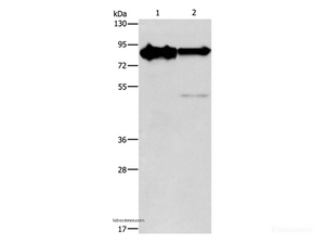 Western Blot analysis of Mouse brain and Human brain malignant glioma tissue using KIF3A Polyclonal Antibody at dilution of 1:750