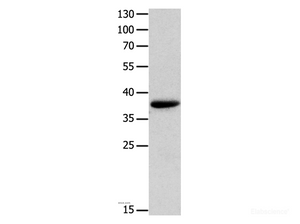 Western Blot analysis of Mouse muscle tissue using MYOZ1 Polyclonal Antibody at dilution of 1:1000