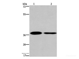 Western Blot analysis of 293T and A549 cell using SNAI1 Polyclonal Antibody at dilution of 1:200