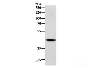 Western Blot analysis of Human lymphoma tissue using SOX-7 Polyclonal Antibody at dilution of 1:750