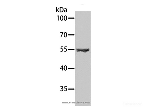 Western Blot analysis of Human testis tissue using SPATA6 Polyclonal Antibody at dilution of 1:1000