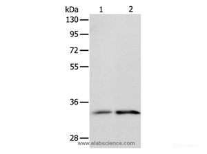 Western Blot analysis of Human fetal kidney and intestine tissue using ST2 Polyclonal Antibody at dilution of 1:1100