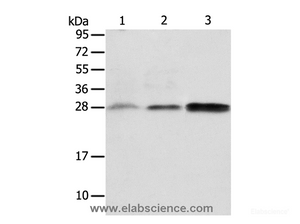Western Blot analysis of Human fetal liver and seminoma tissue, RAW264.7 cell using ALKBH2 Polyclonal Antibody at dilution of 1:650
