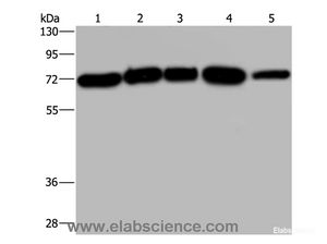 Western Blot analysis of A172, Hela and 293T cell, K562 cell and Human testis tissue using AGFG1 Polyclonal Antibody at dilution of 1:533