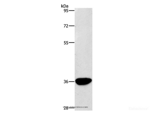 Western Blot analysis of Human liver cancer tissue using AKR1D1 Polyclonal Antibody at dilution of 1:450