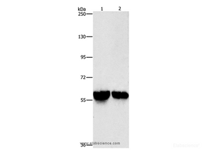 Western Blot analysis of Mouse liver and kidney tissue using ALDH8A1 Polyclonal Antibody at dilution of 1:800