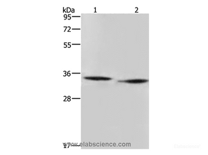 Western Blot analysis of Mouse heart and liver tissue using AMDHD2 Polyclonal Antibody at dilution of 1:500