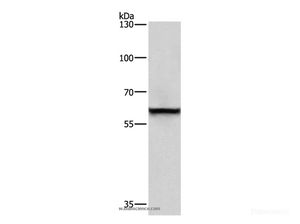 Western Blot analysis of A431 cell using TRIP4 Polyclonal Antibody at dilution of 1:400