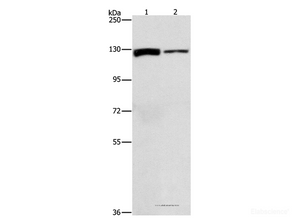 Western Blot analysis of A172 and PC3 cell using ACLY Polyclonal Antibody at dilution of 1:1050