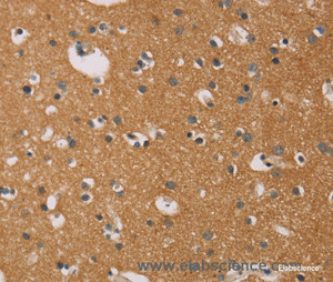 Immunohistochemistry of paraffin-embedded Human brain tissue using CD22 Polyclonal Antibody at dilution 1:50