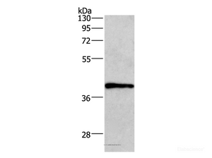 Western Blot analysis of A549 cell using WNT3A Polyclonal Antibody at dilution of 1:400
