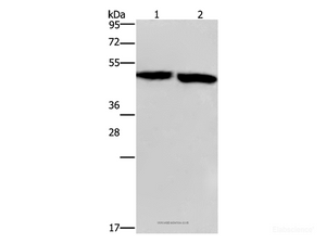 Western Blot analysis of Mouse stomach and brain tissue using CLUAP1 Polyclonal Antibody at dilution of 1:500
