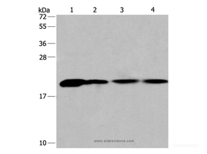 Western Blot analysis of Human fetal liver tissue and 293T cell, Human liver cancer tissue and hela cell using PPIB Polyclonal Antibody at dilution of 1:450