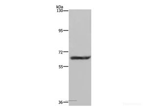 Western Blot analysis of Human fetal brain tissue using FTO Polyclonal Antibody at dilution of 1:650