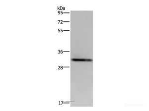 Western Blot analysis of OP9 cell using CD242 Polyclonal Antibody at dilution of 1:500