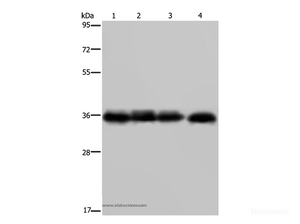 Western Blot analysis of K562 cell and Human kidney cancer tissue, 293T and HepG2 cell using JAM-A Polyclonal Antibody at dilution of 1:600