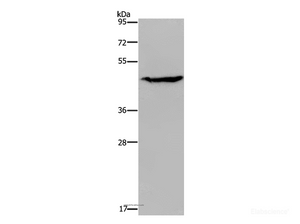 Western Blot analysis of K562 cell using ACP6 Polyclonal Antibody at dilution of 1:200
