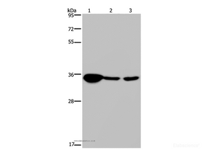 Western Blot analysis of Human testis tissue, 293T and A 172 cell using LZTFL1 Polyclonal Antibody at dilution of 1:300