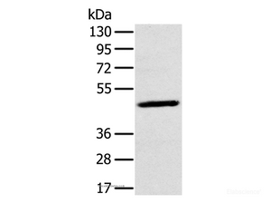 Western Blot analysis of A375 cell using MAGEA10 Polyclonal Antibody at dilution of 1:200