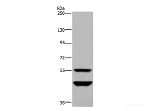 Western Blot analysis of Human testis tissue using MTF2 Polyclonal Antibody at dilution of 1:400