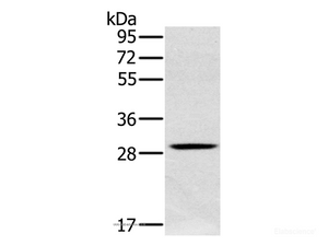 Western Blot analysis of Human testis tissue using CLIC1 Polyclonal Antibody at dilution of 1:400