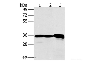 Western Blot analysis of Mouse kidney tissue and Jurkat cell, Mouse heart tissue using NDUFA9 Polyclonal Antibody at dilution of 1:400