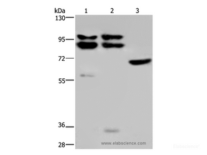 Western Blot analysis of Hela, 231 and NIH/3T3 cell using OS9 Polyclonal Antibody at dilution of 1:200