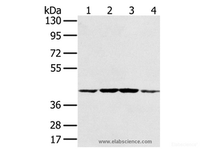 Western Blot analysis of Hela, K562, Raji and Jurkat cell using PAICS Polyclonal Antibody at dilution of 1:550