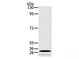 Western Blot analysis of K562 cell using RAB27A Polyclonal Antibody at dilution of 1:400