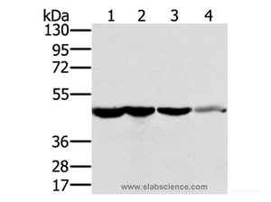 Western Blot analysis of HT-29 cell and Human normal kidney tissue, Lo2 cell and Human normal liver tissue, Human fetal brain tissue using RNH1 Polyclonal Antibody at dilution of 1:400
