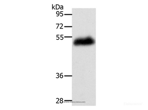 Western Blot analysis of Human leiomyosarcoma tissue using LOX Polyclonal Antibody at dilution of 1:400