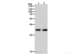 Western Blot analysis of k562 cell and Hela cell using HAVCR1 Polyclonal Antibody at dilution of 1:700