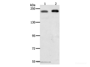 Western Blot analysis of Hela and Jurkat cell using SMARCA4 Polyclonal Antibody at dilution of 1:700